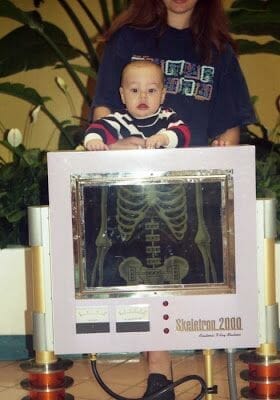 radiografía en EPCOT