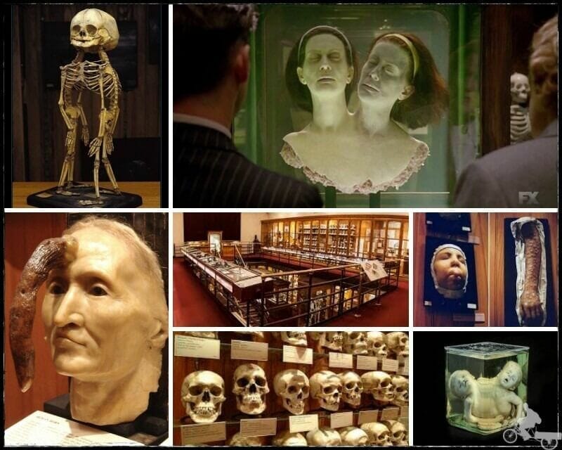 museo Mutter de Filadelfia